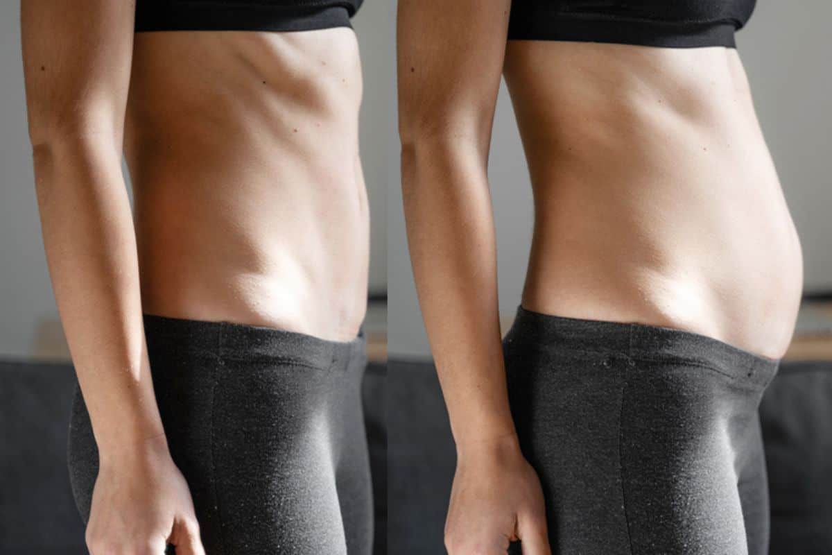 How long does diastasis recti take to improve Salisbury?
