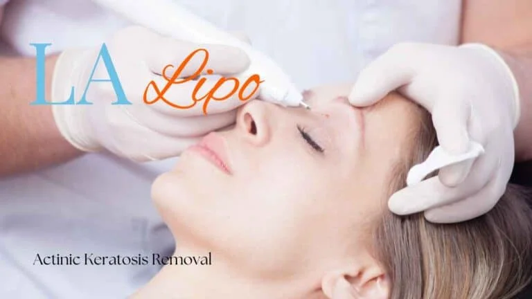 Woman receiving Actinic Keratosis Removal Treatment Salisbury