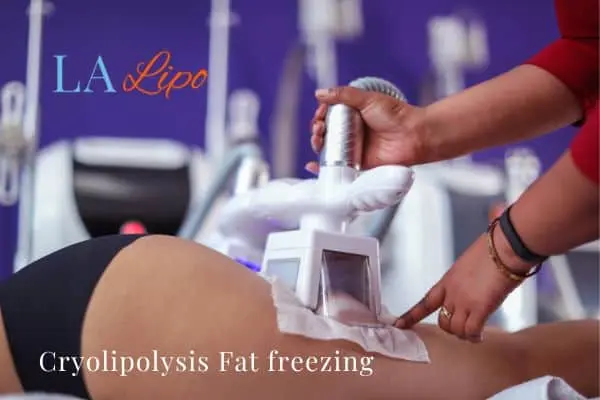 women getting fat freezing Salisbury