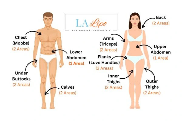 LA LIPO Cryolipolysis Areas Salisbury