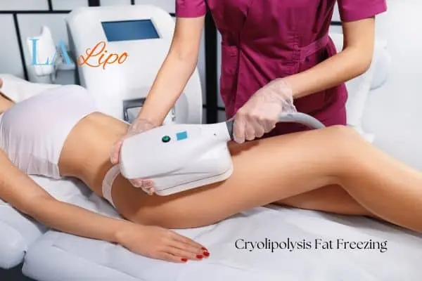 Woman receiving coolsculpting Salisbury treatment on her thighs
