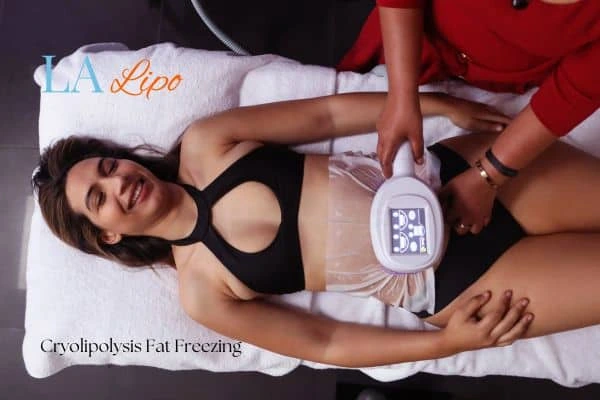 woman getting cryolipolysis Salisbury