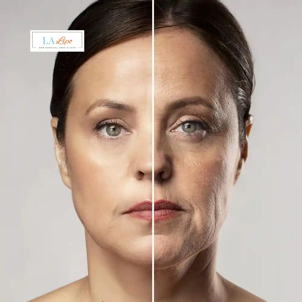 How Can You Tell If Non-Surgical Skin Tightening Is Right for You Salisbury?