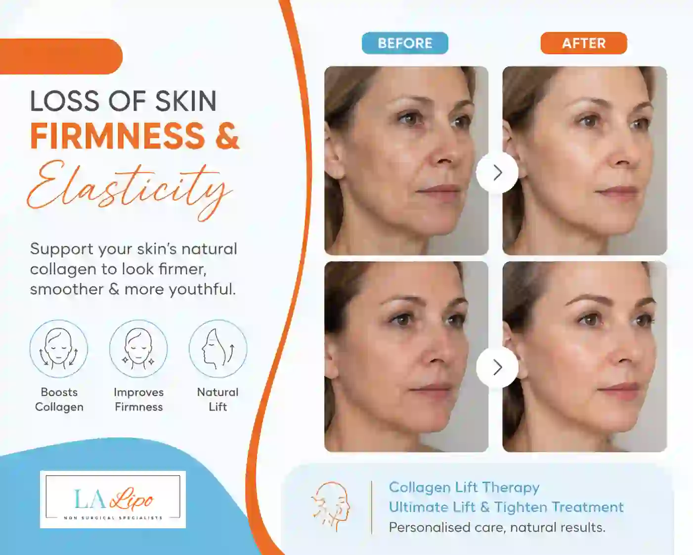 Sign #7: Loss of Skin Firmness and Elasticity Salisbury