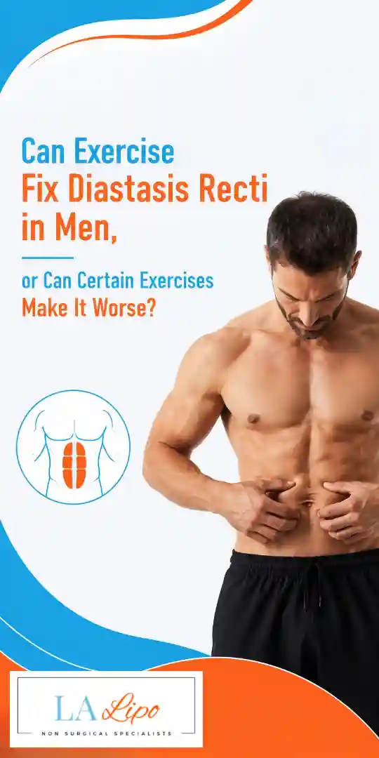 Can Exercise Fix Diastasis Recti in Men, or Can Certain Exercises Make It Worse Salisbury?